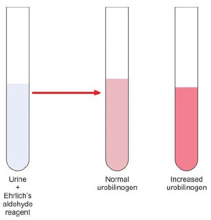 Ehrlichs aldehyde test for urobilinogen