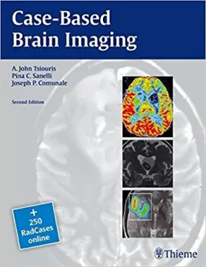 Case-Based Brain Imaging (RadCases) by A. John Tsiouris (2013-02-19)